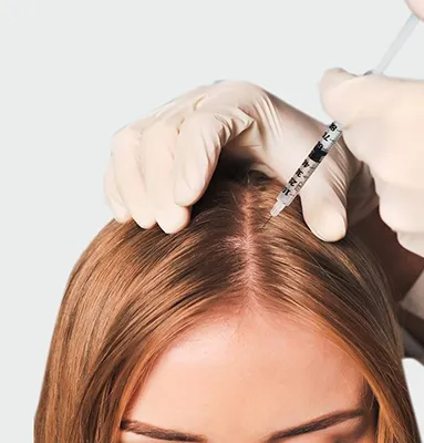 Saç Mezoterapisi