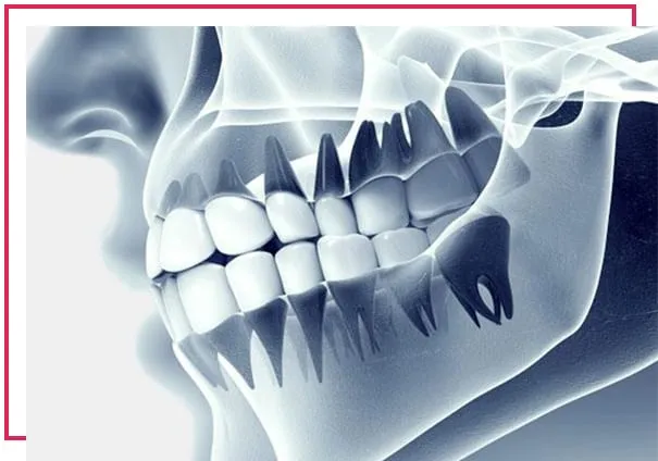 AĞIZ, DİŞ VE ÇENE RADYOLOJİSİ