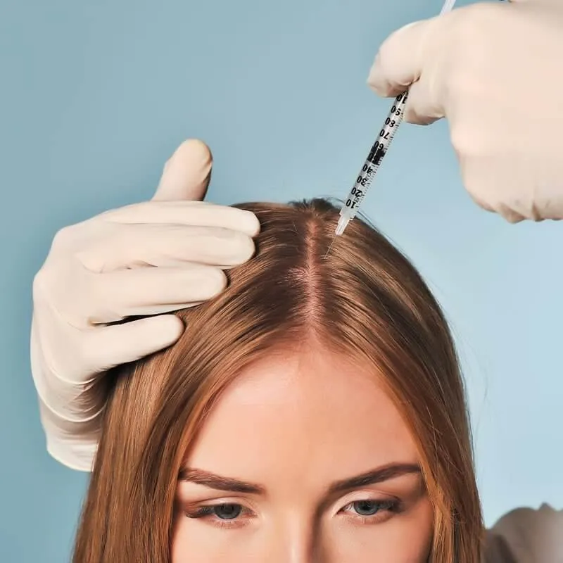 Saç Mezoterapisi